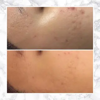 ミディアム カラー パーマ ヘアアレンジ メンズ キッズ ネイル マツエク・マツパ アイブロウ 触れたくなる モテ肌へ...❤︎のエステ・リラクイメージ