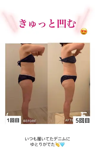 産後ダイエット−9㎏ Pourvous結衣のエステ・リラクイメージ