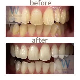 ホワイトニング ショップ船橋店🦷のエステ・リラクイメージ