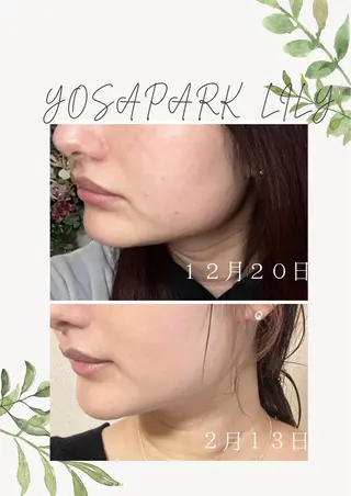 温活痩身サロン LILYのエステ・リラクイメージ