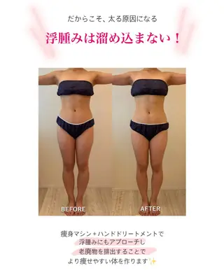 産後ダイエット−9㎏ Pourvous結衣のエステ・リラクイメージ