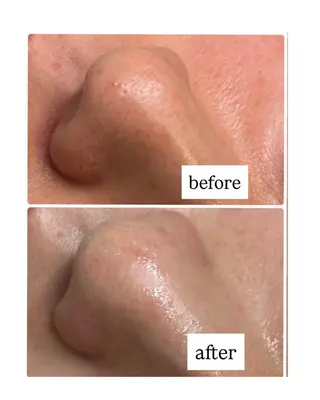 Salon【yuzu.】所属・🍊肌管理×美眉 【yuzu.】の眉毛・アイブロウイメージ