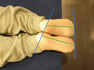 ピュアプロポーション美容整体カイロ院所属・小顔/美姿勢/肩凝り ピュアプロポーションのエステ・リラクイメージ