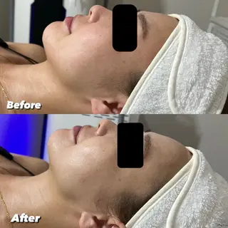 脱毛＆Beauty salon IILA所属・垢抜けお手伝い💖 Sakuraの眉毛・アイブロウイメージ