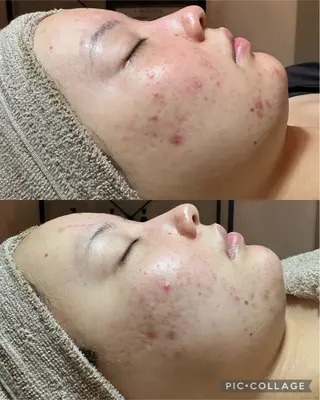 エステ✖️ネイル Feelのネイルデザイン