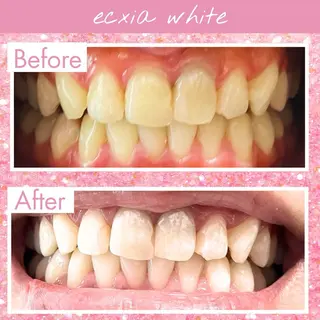 セルフホワイトニング エクシア戸田公園店所属・セルフホワイトニング エクシア戸田公園店のその他イメージ