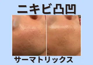 メンズ 【BUB立川】 ゆかのエステ・リラクイメージ