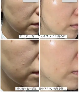 潤い艶肌・身体ケア ／貸切りサロンソワンのエステ・リラクイメージ