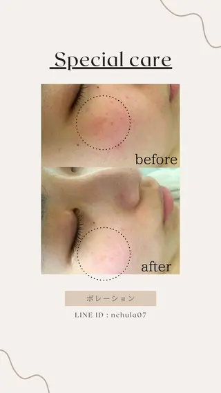 KOHAKU.所属・Nana Kikutaのエステ・リラクイメージ