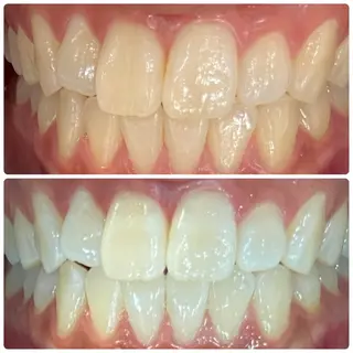 メンズ PLATINUM Beauty 横浜店所属・ホワイトニングルーム 横浜店のその他イメージ