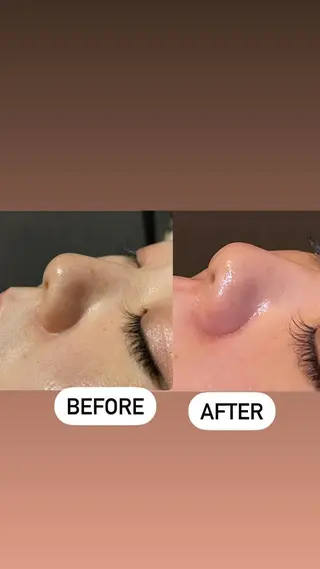 メンズ眉毛ITSUK Iメンズ専門　新宿の眉毛・アイブロウイメージ