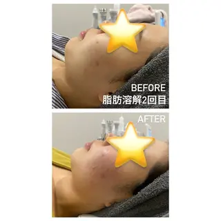 毛穴洗浄・痩身・脱毛 /アルカンジュのエステ・リラクイメージ