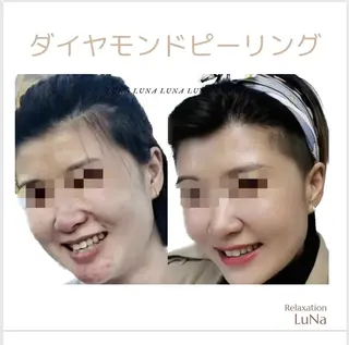 リラクゼーション ルナのエステ・リラクイメージ