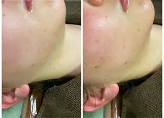 🔰 新米ネイリストのネイルデザイン