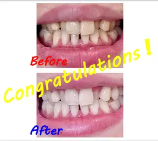 セルフホワイトニングサロン　ラヴィアン所属・ホワイトニングサロン La vie enのその他イメージ