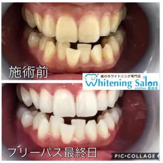 歯科レベルの白さ💎 ✨ホワイトニング豊田のエステ・リラクイメージ