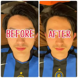 メンズ ジェイペック所属・整体×美容鍼 ジェイペックのエステ・リラクイメージ