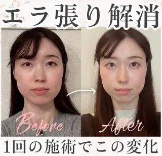 小顔矯正専門サロンAxiune所属・小顔矯正専門 🪽アシュネ平野のエステ・リラクイメージ