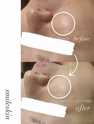 smileskin 京都／meguのその他イメージ