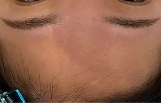 べアール所属・小顔/毛穴/ニキビ salon bealのエステ・リラクイメージ