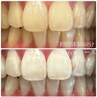 ホワイトニングルーム　川崎店所属・ホワイトニング ルーム　川崎店のその他イメージ