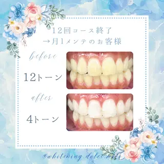 セルフホワイトニング Dolce八王子店のその他イメージ