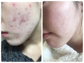 プライベートサロン Perla所属・Perla 齊藤のマツエク・マツパデザイン