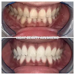 メンズ ライトビューティー 錦糸町店のエステ・リラクイメージ