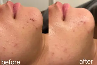 小顔＆まつ毛サロン AKANE❤️のエステ・リラクイメージ