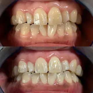 藤本 真心のネイルデザイン