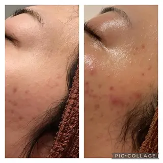 セミロング カラー パーマ ヘアアレンジ メンズ キッズ ネイル マツエク・マツパ アイブロウ ニキビ特化型エステ 🍓最短で肌質改善のエステ・リラクイメージ