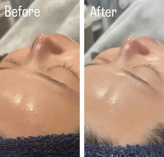 アンド ミルルのエステ・リラクイメージ