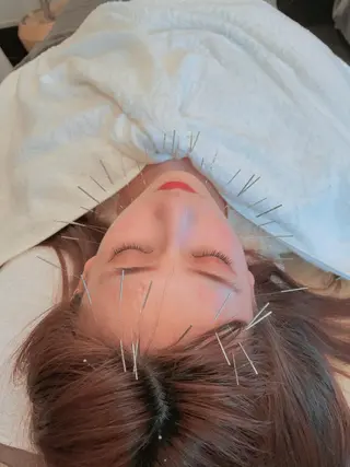 美容鍼・鍼灸専門❤✨ 近藤めぐみのエステ・リラクイメージ