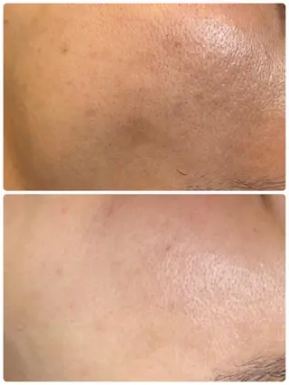 調律エステ /美KISSのその他イメージ