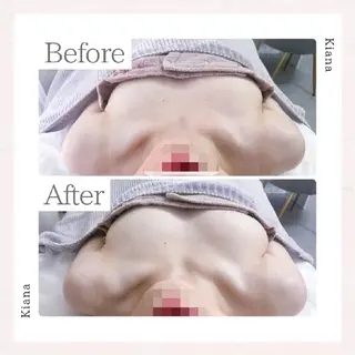 【バスト専門店 】 Kiana のエステ・リラクイメージ