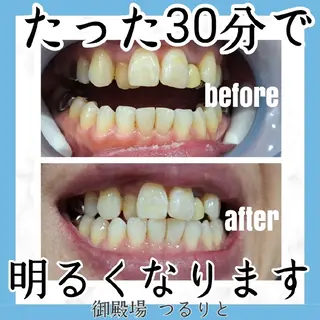 美肌脱毛サロン つるりと御殿場店所属・美肌脱毛サロン つるりとのその他イメージ