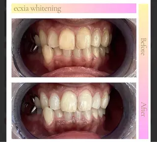 セルフホワイトニング エクシア盛岡中央通店所属・セルフホワイトニング エクシア盛岡あっくんのエステ・リラクイメージ