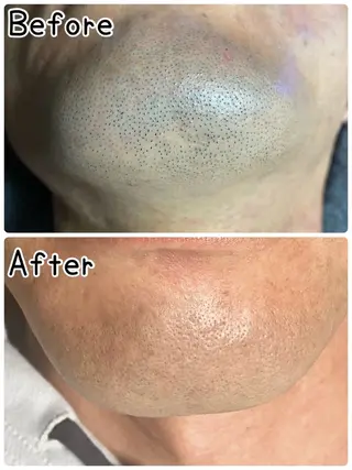 TotalSalon /JASMINEのネイルデザイン