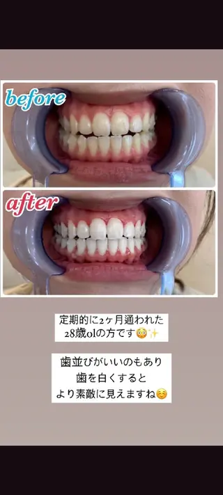 セルフホワイトニングサロン エクシア江坂店所属・セルフホワイトニング エクシア江坂店のエステ・リラクイメージ