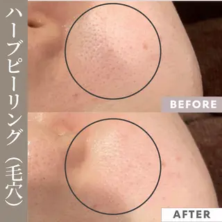 【フェムケア専門店】 PEQLIAヒロミのエステ・リラクイメージ