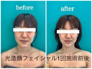 🩵Tatsumi Kana🩵のエステ・リラクイメージ