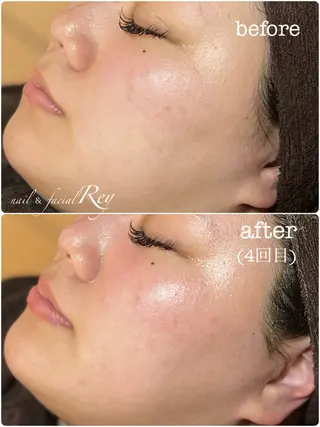 R eyのネイルデザイン