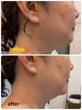 A.Nails salonのエステ・リラクイメージ