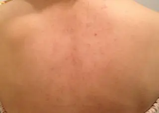 痩身リンパダイエット 隠れ家サロンチャームのエステ・リラクイメージ