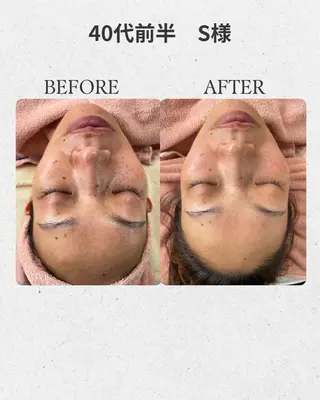 Salon  de LINON所属・Salon de  LINONのエステ・リラクイメージ