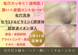 毛穴フェイシャル エステ専門店BBのエステ・リラクイメージ