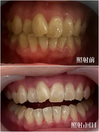 𝐑𝐞𝐯𝐢𝐨 ___堺市西区のマツエク・マツパデザイン