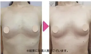 小顔と腸の専門店 ラクーラビューティのエステ・リラクイメージ