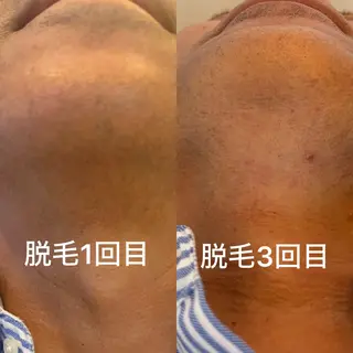 メンズ eto ileのエステ・リラクイメージ