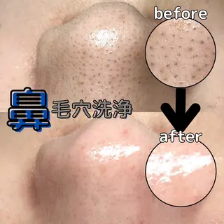 Diailes💎 さいかのエステ・リラクイメージ